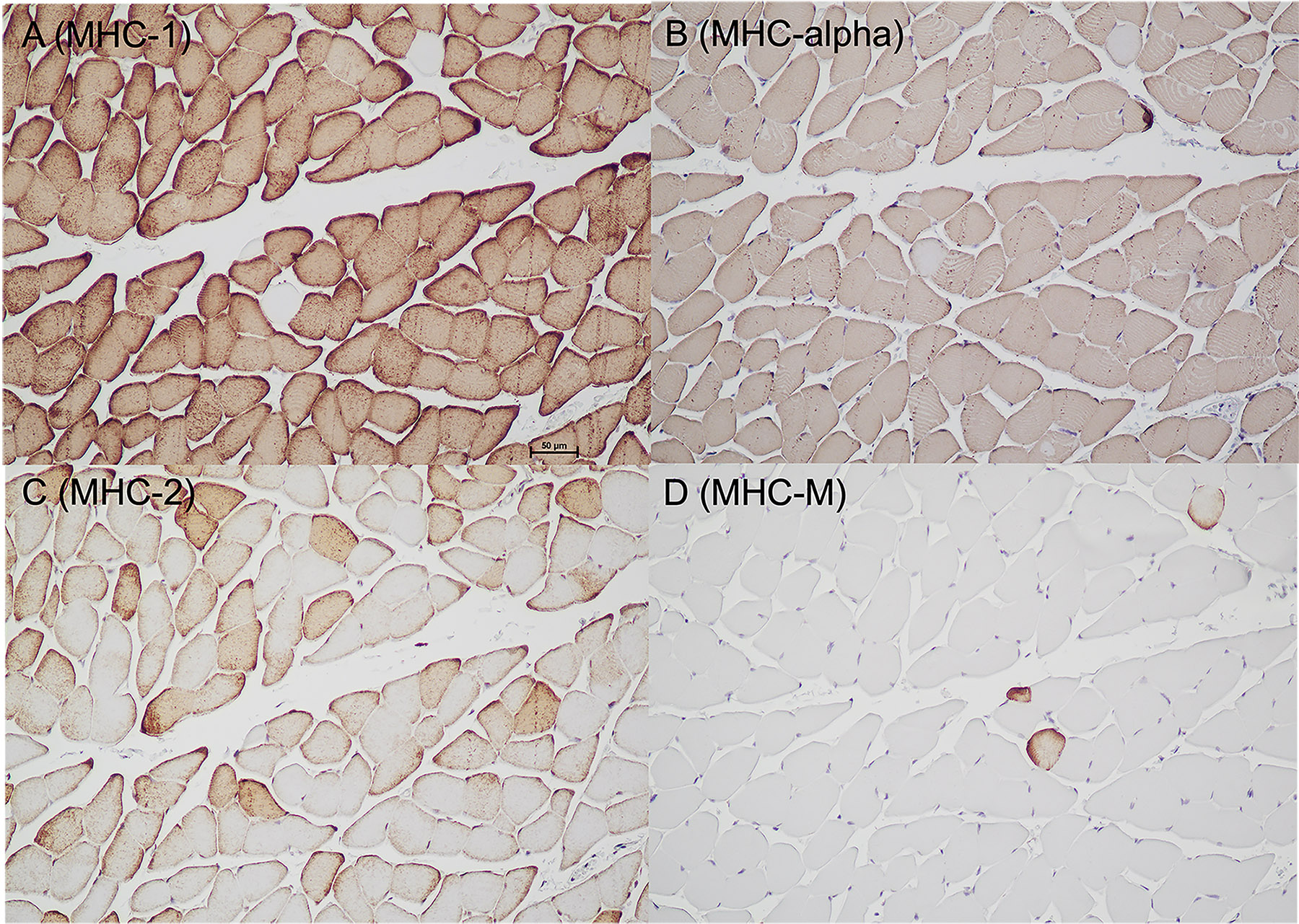 Serial sections showing the four major myosin heavy chain (MHC) isoforms expressed in sooty mangabey superficial masseter. A) MHC-1, B) MHC-α, C) MHC-2, and D) MHC-M (masticatory myosin). Note the abundance of hybrid fibers (co-staining of fibers expressing MHC-1, MHC-alpha, and MHC-2) and counterstaining between MHC-1 and MHC-M.